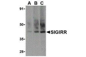 Western Blotting (WB) image for anti-Single Immunoglobulin and Toll-Interleukin 1 Receptor (TIR) Domain (SIGIRR) (C-Term) antibody (ABIN2476475) (SIGIRR antibody  (C-Term))