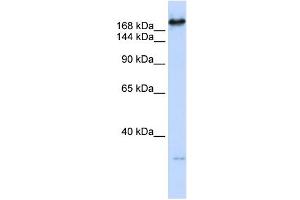 CAD antibody used at 1 ug/ml to detect target protein.
