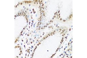 Immunohistochemistry of paraffin-embedded human stomach using Ku80 antibody (ABIN6130932, ABIN6150308, ABIN6150310 and ABIN6217336) at dilution of 1:100 (40x lens). (XRCC5 antibody  (AA 540-732))