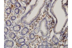 Immunoperoxidase of monoclonal antibody to HSD17B1 on formalin-fixed paraffin-embedded human small Intestine. (HSD17B1 antibody  (AA 189-285))