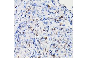 Immunohistochemistry (IHC) image for anti-Cyclin D1 (CCND1) antibody (ABIN7266561)