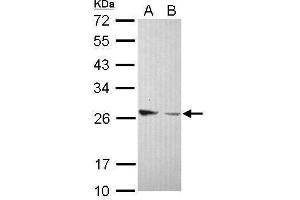 WB Image Sample (30 ug of whole cell lysate) A: IMR32 B: U87-MG 12% SDS PAGE antibody diluted at 1:1000 (Amphiregulin antibody)