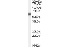 Western Blotting (WB) image for anti-Fatty Acid Desaturase Domain Family, Member 6 (FADS6) (C-Term) antibody (ABIN2791499) (FADS6 antibody  (C-Term))