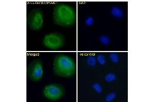 ABIN570956 Immunofluorescence analysis of paraformaldehyde fixed U2OS cells, permeabilized with 0.