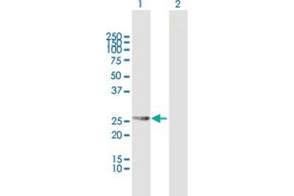 RDH13 antibody  (AA 1-260)