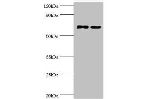 Western blot All lanes: Myotubularin-related protein 14 antibody at 10 μg/mL Lane 1: Hela whole cell lysate Lane 2: Mouse skeletal muscle tissue Secondary Goat polyclonal to rabbit IgG at 1/10000 dilution Predicted band size: 73, 67, 61 kDa Observed band size: 73 kDa (MTMR14 antibody  (AA 1-280))