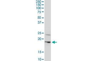 BTF3L4 monoclonal antibody (M05), clone 2G10. (BTF3L4 antibody  (AA 1-158))