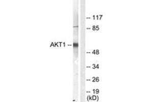 Western blot analysis of extracts from NIH-3T3 cells, treated with Serum 10% 30', using Akt (Ab-450) Antibody. (AKT1 antibody  (AA 416-465))