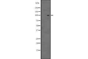 Western blot analysis of MYOCD expression in HEK293 cells ,The lane on the left is treated with the antigen-specific peptide. (Myocardin antibody  (Internal Region))