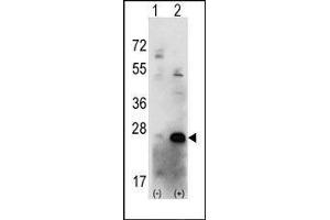 Western blot analysis of CSNK2B (arrow) using rabbit polyclonal CSNK2B Antibody (CSNK2B antibody  (C-Term))