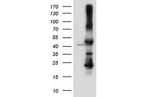 HEK293T cells were transfected with the pCMV6-ENTRY control (Left lane) or pCMV6-ENTRY SERPINB6 (Right lane) cDNA for 48 hrs and lysed. (SERPINB6 antibody)