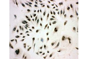 Anti-MCM3 antibody, ICC ICC: HELA Cell (MCM3 antibody  (N-Term))
