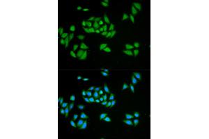 Immunofluorescence analysis of HeLa cells using UPF1 antibody. (RENT1/UPF1 antibody)