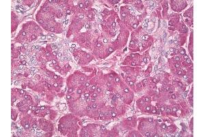 Human, Pancreas: Formalin-Fixed Paraffin-Embedded (FFPE). (GTPase NRas antibody  (AA 91-140))