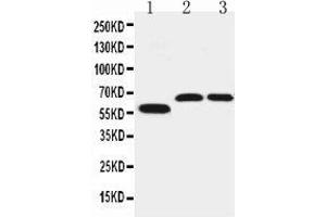 Anti-SLC1A4 antibody, Western blotting Lane 1: U87 Cell Lysate Lane 2: Rat Brain Tissue Lysate Lane 3: Mouse Brain Tissue Lysate