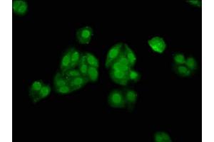 Immunofluorescence staining of HepG2 cells with ABIN7155641 at 1:133, counter-stained with DAPI. (ALX3 antibody  (AA 11-127))
