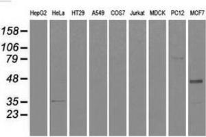Western blot analysis of extracts (35 µg) from 9 different cell lines by using anti-CD4 monoclonal antibody. (CD4 antibody)