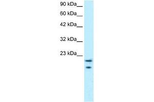 WB Suggested Anti-MYCBP Antibody Titration: 0. (MYCBP antibody  (Middle Region))
