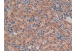 Detection of RSPO1 in Rat Kidney Tissue using Polyclonal Antibody to R-Spondin 1 (RSPO1)