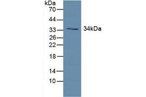 Western blot analysis of Human Lung Tissue. (Growth Hormone Receptor antibody  (AA 315-574))