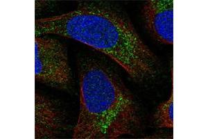 Immunofluorescent staining of human cell line U-2 OS shows positivity in vesicles.