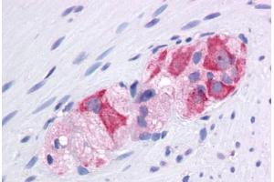 Human Colon, Myenteric Plexus: Formalin-Fixed, Paraffin-Embedded (FFPE) (HSP90AA1 antibody  (AA 108-157))