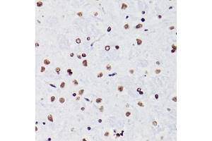 Immunohistochemistry of paraffin-embedded rat brain using H3K18ac antibody (ABIN7267668) at dilution of 1:100 (40x lens). (Histone 3 antibody  (H3K18))