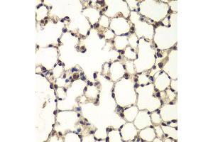 Immunohistochemistry of paraffin-embedded mouse lung using PHF11 antibody at dilution of 1:100 (x400 lens). (PHF11 antibody)
