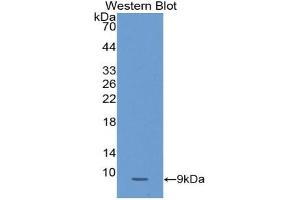 Western Blotting (WB) image for anti-serpin Peptidase Inhibitor, Clade B (Ovalbumin), Member 4 (SERPINB4) (AA 320-390) antibody (ABIN2912603)