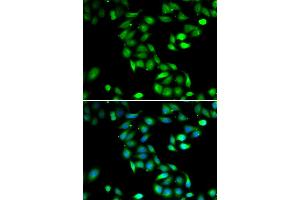 Immunofluorescence analysis of HeLa cells using PDCD6 antibody (ABIN5974030).