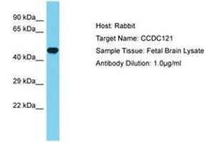 Image no. 1 for anti-Coiled-Coil Domain Containing 121 (CCDC121) (AA 197-246) antibody (ABIN6750672) (CCDC121 antibody  (AA 197-246))