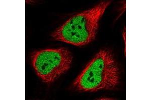 Immunofluorescent staining of human cell line U-2 OS with POLR3E polyclonal antibody  at 1-4 ug/mL dilution shows positivity in nucleus but not nucleoli.