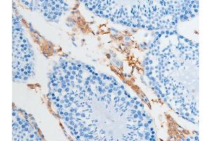 ABIN6255391 and ABIN6267252 at 1/100 staining rat testicular tissue sections by IHC-P.