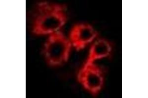 Immunofluorescent analysis of C4BP beta staining in Hela cells. (C4BPB antibody)