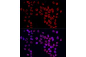 Immunofluorescence analysis of HeLa cells using YE Rabbit pAb (ABIN6130808, ABIN6150331, ABIN6150332 and ABIN6221925) at dilution of 1:50 (40x lens). (GAS41 antibody  (AA 1-227))