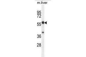 TBCCD1 Antibody (C-term) western blot analysis in mouse liver tissue lysates (35µg/lane). (TBCCD1 antibody  (C-Term))
