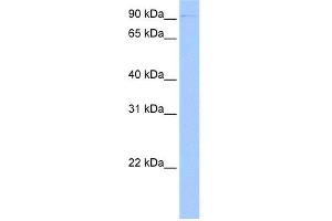 WB Suggested Anti-CTBP2 Antibody Titration:  0. (CTBP2 antibody  (C-Term))