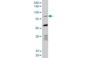 DAZ1 monoclonal antibody (M06), clone 3E3.