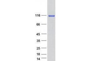 Western Blotting (WB) image for Protein Kinase N1 (PKN1) (Transcript Variant 2) protein (Myc-DYKDDDDK Tag) (ABIN2729066)
