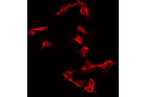 ABIN6267376 staining NIH-3T3 by IF/ICC. (Glycogen Synthase 1 antibody  (pSer645))