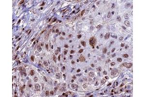 ABIN6266946 at 1/100 staining human lung tissue sections by IHC-P.