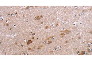 Immunohistochemistry of paraffin-embedded Human brain using PPP2R3C Polyclonal Antibody at dilution of 1:30 (PPP2R3C antibody)