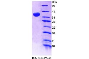 SDS-PAGE (SDS) image for Guanylate Binding Protein 4 (GBP4) (AA 1-304) protein (His tag) (ABIN4988855) (GBP4 Protein (AA 1-304) (His tag))