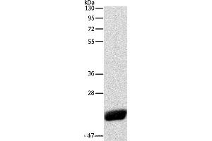 Western blot analysis of Human leiomyosarcoma tissue, using CAV1 Polyclonal Antibody at dilution of 1:525 (Caveolin-1 antibody)