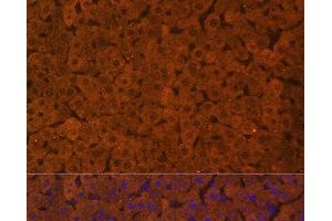 Immunofluorescence analysis of Rat liver using UGT1A1 Polyclonal Antibody at dilution of 1:100. (UGT1A1 antibody)