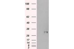 HEK293T cells were transfected with the pCMV6-ENTRY control (Left lane) or pCMV6-ENTRY HHex (RC204815) (Right lane) cDNA for 48 hrs and lysed. (HHEX antibody  (AA 100-270))