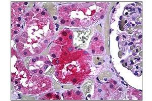 Immunohistochemistry (IHC) image for anti-Galactose-1-Phosphate Uridylyltransferase (GALT) antibody (ABIN781864) (GALT antibody)