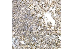 Immunohistochemistry (IHC) image for anti-Transcription Factor 7 (T-Cell Specific, HMG-Box) (TCF7) antibody (ABIN7270885)