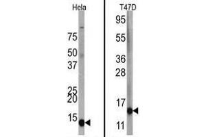 Image no. 1 for anti-Finkel-Biskis-Reilly Murine Sarcoma Virus (FBR-MuSV) Ubiquitously Expressed (FAU) (C-Term) antibody (ABIN357136) (FAU antibody  (C-Term))