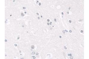 Detection of LMNB1 in Human Cerebrum Tissue using Polyclonal Antibody to Lamin B1 (LMNB1) (Lamin B1 antibody  (AA 52-233))
